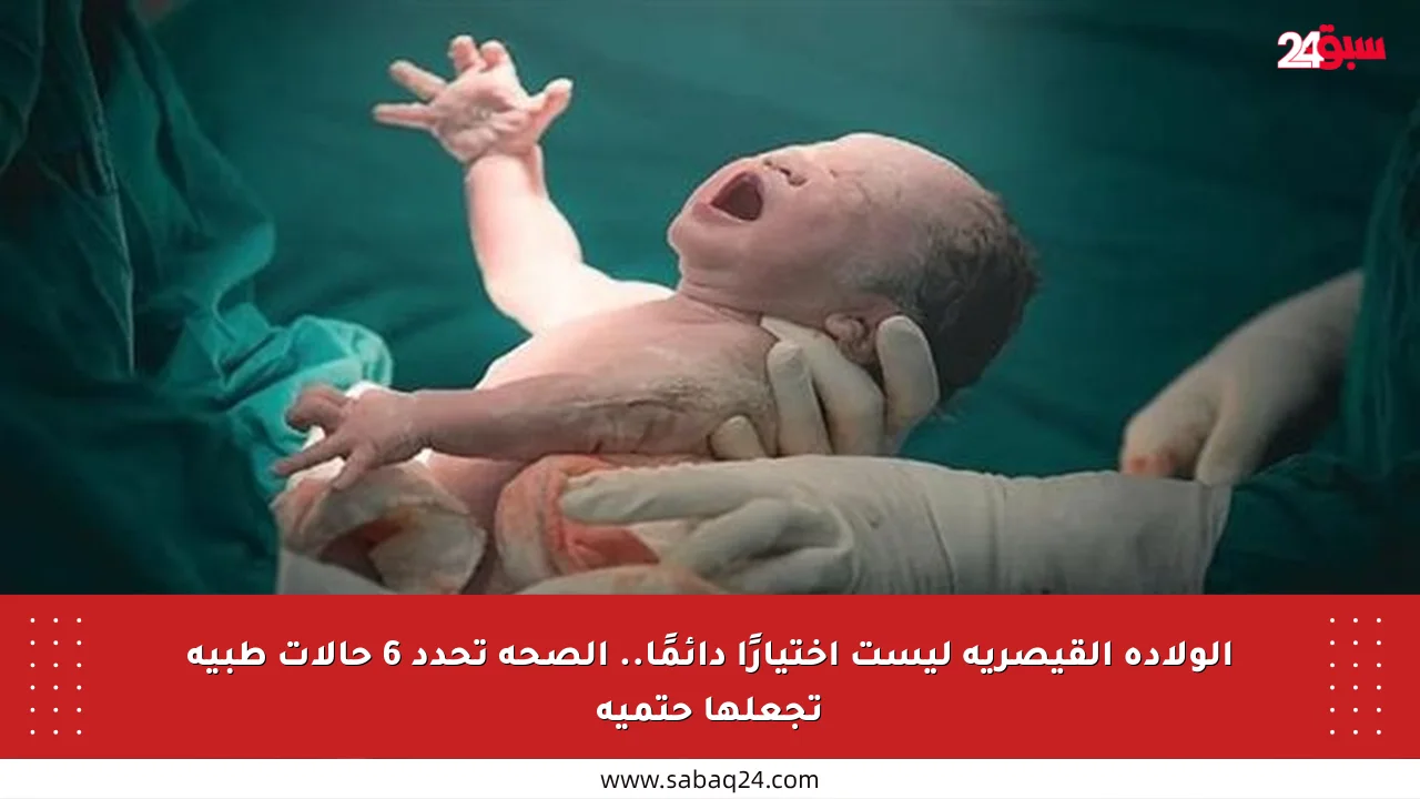 الولادة القيصرية ليست اختيارًا دائمًا.. الصحة تحدد 6 حالات طبية تجعلها حتمية